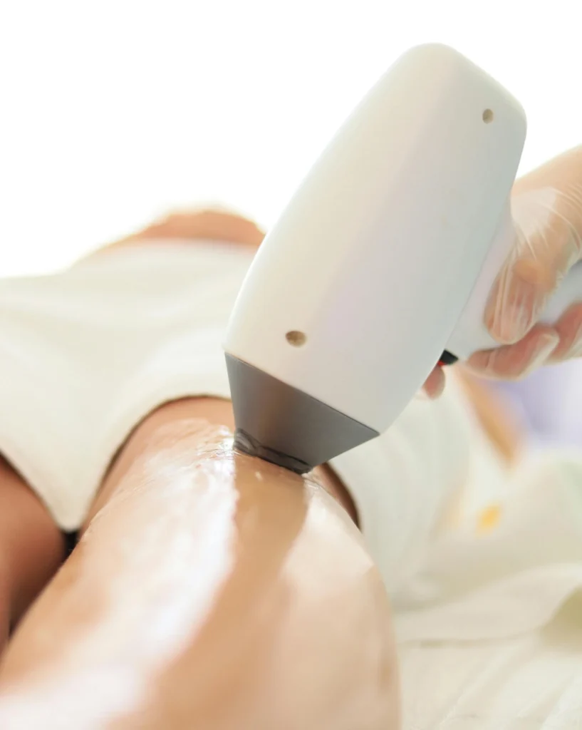 808nm diode laser handpiece delivering stable power output during hair removal treatment